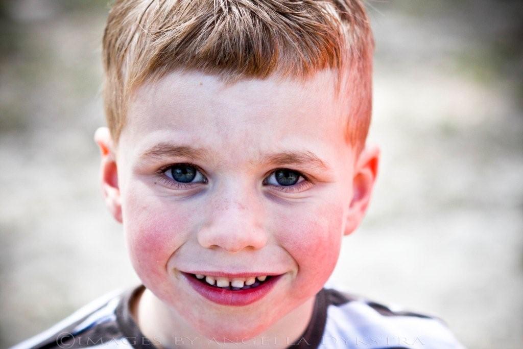 Freckles!